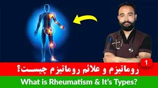 روماتیسم چیست و انواع روماتیزم چیست | داکتر عبدالهادی شیرزاد | داکترستان ❤ What is Rheumatism Types