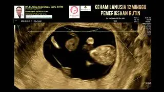Pemeriksaan kehamilan 12 minggu