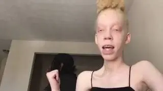 Albino Rapper Goes HARD AF