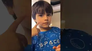 Arı mı yedi 😂😂