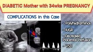 Ultrasound Case of Diabetic Mother with Pregnancy and Multiple Complications