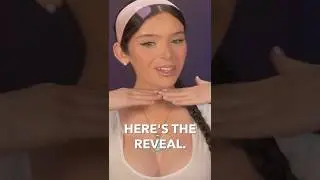 Facial Feminization Surgery REVEAL & Procedures Explained (Transgender Transition Update)