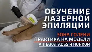 Обучение лазерной эпиляции  Практика, зона голени  Аппараты Honkon и ADSS