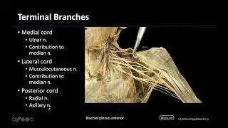 Brachial Plexus - M1 Dissection Supplement