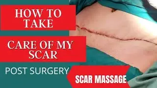 TUMMYTUCK SCAR/POST OP CARE  MASSAGE AND SCAR TREATMENTS