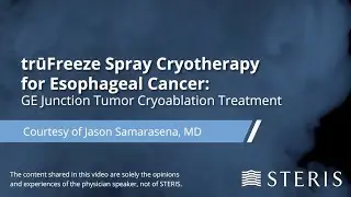 trūFreeze® Spray Cryotherapy for Esophageal Cancer: GE Junction Tumor Cryoablation Treatment