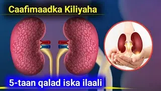 Caafimaadka Kiliyaha - 5-taan qalad ka ilaali kiliyahaada Si ee u dhaawicin
