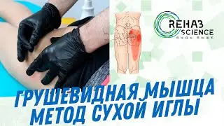 Грушевидная мышца, метод сухой иглы