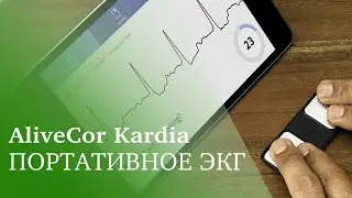 Портативный гаджет AliveCor Kardia для снятия ЭКГ и мониторинга работы сердца