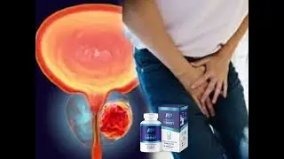 ⭐POWER PROST ⭐POWER PROST TRATA DA PRÓSTATA AUMENTADA? ⭐POWER PROST FUNCIONA MESMO? ⭐ONDE COMPRAR?