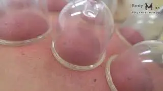 Повышенное давление. Нарушение венозного оттока от головы. Зажатая шея