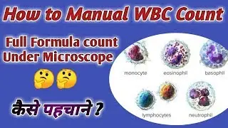 wbc manual count | wbc count under microscope | wbc count manual formula