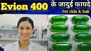 Vitamin e/vitamin e capsule for skin/evion 400/evion 400 capsule/evion 400 capsule ke fayde/evion