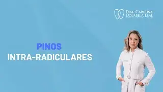 Pinos intra-radiculares - reanatomização