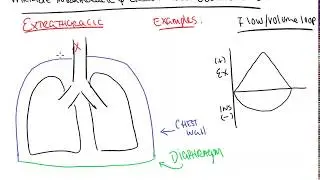 Variable intra and extra thoracic obstructions