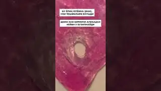 Qizlik pardasi haqida.