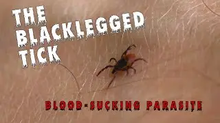Tiny Ticks, Big Troubles: Stay Safe From Blacklegged Ticks
