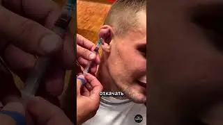 What's Hiding Behind a Wrestler's Ear? A Real Health Threat 👂⚠️ 