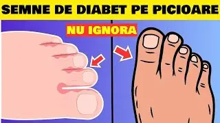 10 SEMNE PRIN CARE PICIOARELE TALE IȚI SPUN CĂ AI DIABET!