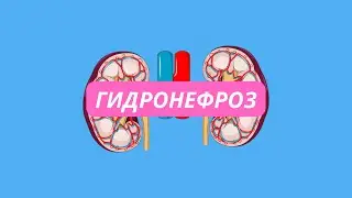 Гидронефроз, физиология развития, диагностика, лечение