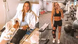 my acl journey & recovery update!