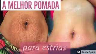 TESTEI E ENSINEI MÉTODO DE ACABAR COM ESTRIAS /FLACIDEZ + FOTOS E VÍDEOS ANTES E DEPOIS !!!