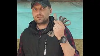 Жгут Эсмарха. Верхние конечности.