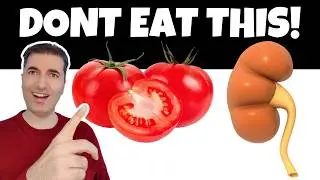 The Worst FOODS for the Kidneys—Explained by MarioLab