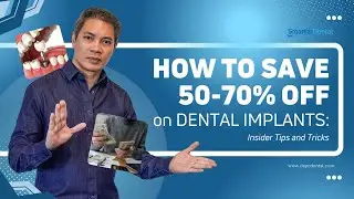How to Save 50-70% on Dental Implants: Insider Tips & Tricks