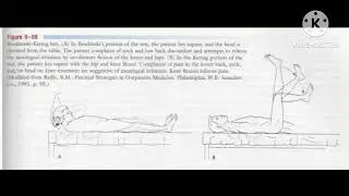 Brudzinski - kernig test | Special test for meningeal irritation |