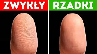 Jak żyją ludzie bez odcisków palców i inne ciekawostki ze świata