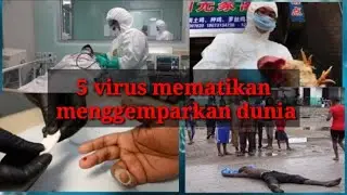 Selain Virus Corona, 5 Penyakit Mematikan Ini Pernah Menggemparkan Dunia
