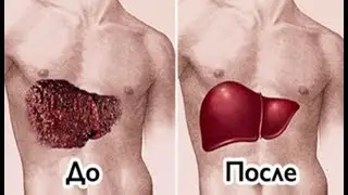 Жигарни 100%  Тозаловчи Таббий Коктейл