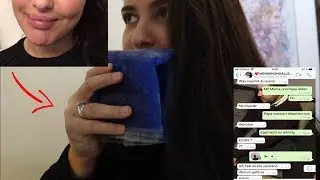 PRANK LIPPEN AUFGESPRITZT ! Oguz rastet aus 😳😂