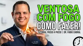 Como fazer ventosa com fogo?