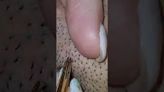 Ulat Dalam Wajah 