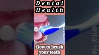 tooth brushing technique #viral #viralvideo #dental #how #everyone #foryou @everyone