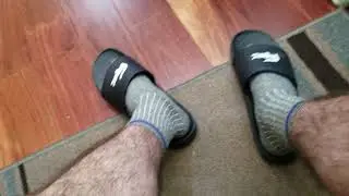 My super hairy legs
