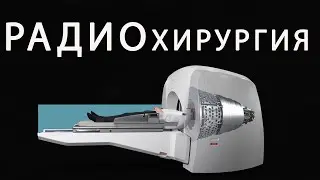 Радиохиругия убивает клетки опухоли мозга!  Что это такое?