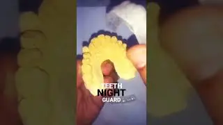 TEETH NIGHTGUARD#varanasi#india#shortvideo#youtuber#shortvideo#shorts#india#america#unitedstates#new