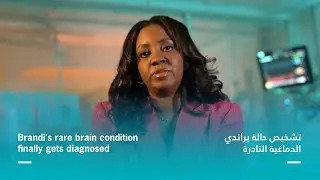 Brandi's rare brain condition finally gets diagnosed