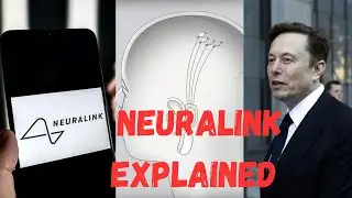 Elon Musk's start-up Neuralink implants first chip in human brain
