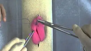 Cushing and Connell Suture Patterns