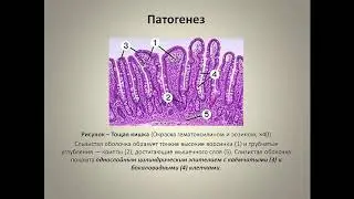 Вахрушева Т.И. Сальмонеллезы млекопитающих и птицы