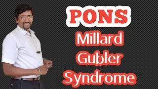 PONS ( part -5) applied anatomy. Millard Gubler syndrome