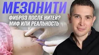 НИТЕВОЙ ЛИФТИНГ ФИБРОЗ Миф или Реальность? | Споры с пластическими хирургами 
