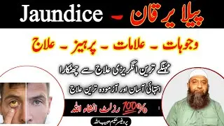 Jaundice Symptoms, Causes & Treatment l Peela Yarkan l پیلا یرکان کا شافی علاج l Hakeem Habib Ullah