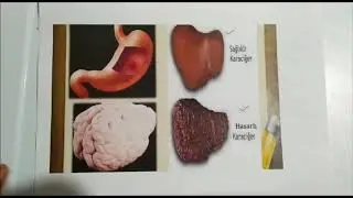4. Sınıf sigara ve alkolün zararları
