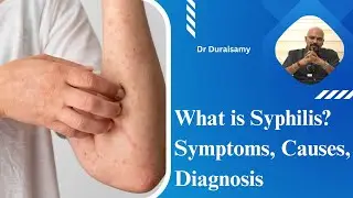 What Is Syphilis? Symptoms, Causes, & Diagnosis | Tamil |  Patient education I MIC