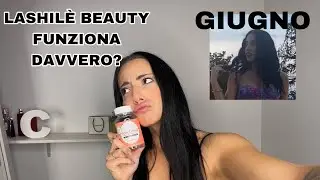 LASHILÈ BEAUTY MI HA FATTO DIVENTARE I CAPELLI LUNGHISSIMI: LE VITAMINE FUNZIONANO DAVVERO?